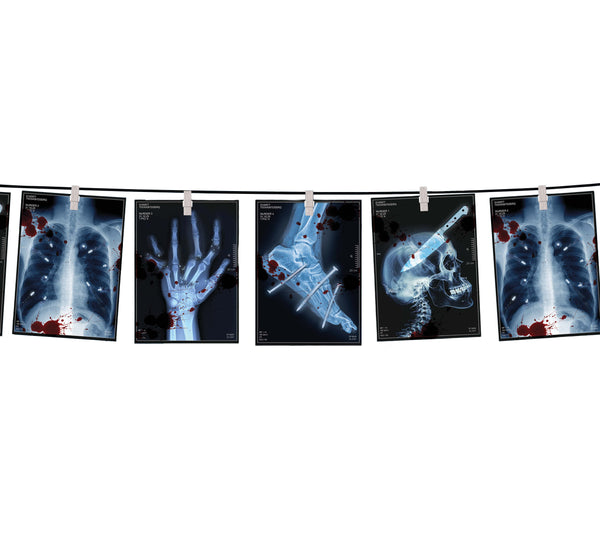 Radiographic Halloween Party Garland
